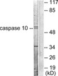 Western blot analysis of lysates from HeLa cells, using Caspase 10 Antibody. The lane on the right is blocked with the synthesized peptide.